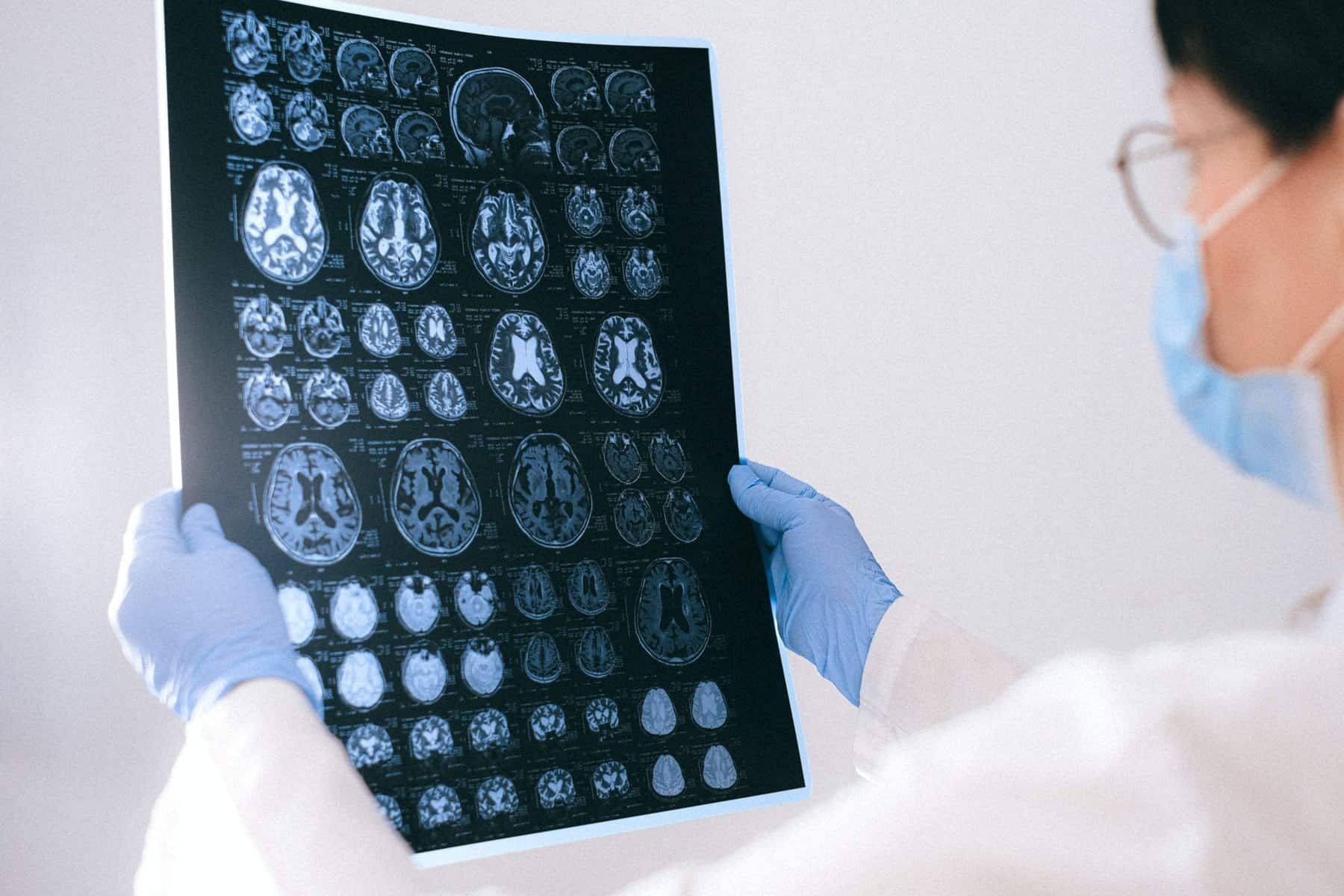 parts of the brain affected by alcohol parts of the brain affected by alcohol parts of the brain affected by alcohol parts of the brain affected by alcohol parts of the brain affected by alcohol parts of the brain affected by alcohol parts of the brain affected by alcohol parts of the brain affected by alcohol parts of the brain affected by alcohol