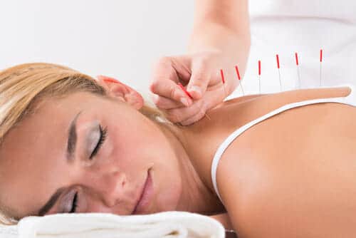 What Are The Benefits Of Acupuncture Treatment In Addiction Treatment?